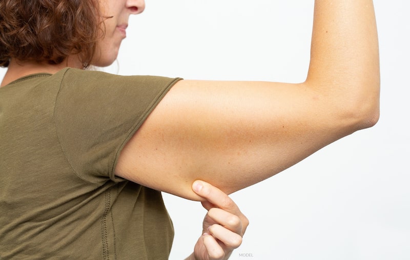 Profile of a woman pinching flabby skin under her arm